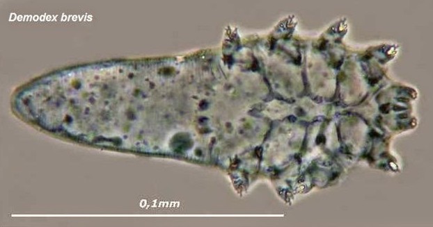 Demodex Brevis